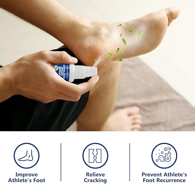 Athletes Foot Spray-Athletes Foot Treatment for Itchy, Sweaty & Uncomfortable Skin, Gently Soothes Feet, Toes & Groin Area | Deodorizing, 1.01 Fl.Oz
