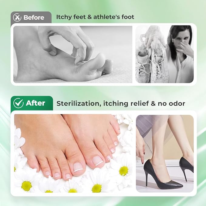 Antimicrobial Foot Spray with Tea Tree Oil, Quick Antiperspirant to Remove Foot Odor and Refreshing and Comfortable (2)