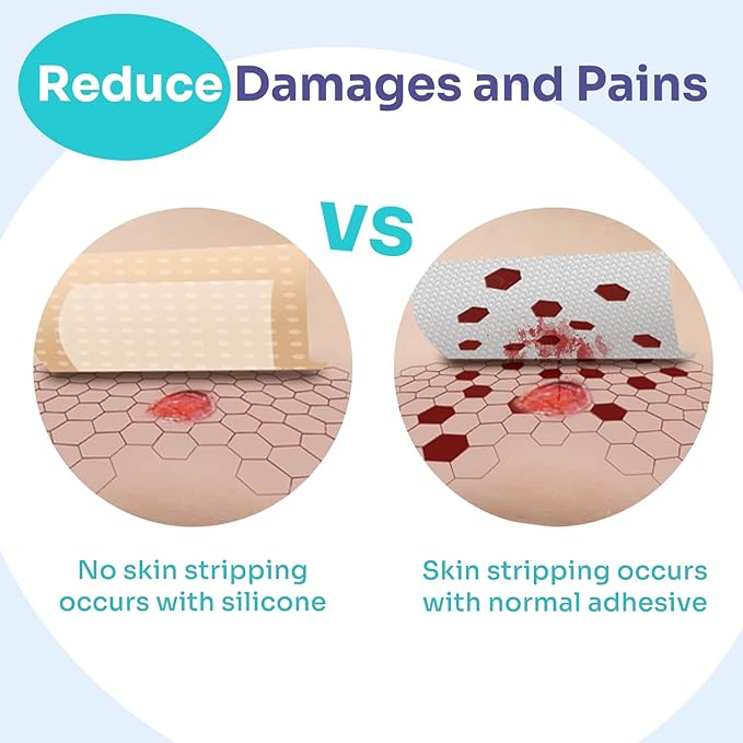 Conkote Silicone Foam Dressings 4'' X 4'', Large Bandages for Bedsores, Wound Care, Box of 20 Dressings