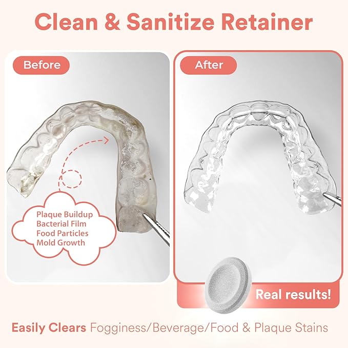 Weiss Naturals Retainer Cleaning Tablets, Invisalign Cleaner, Remove Stains, Odors & Plaque, Night Guard Cleaner PERSULFATE & DYE-FREE 2-Month Supply, Denture Cleaners, 60 Tablets