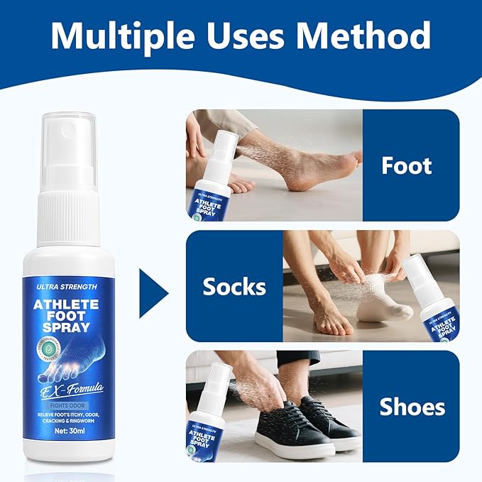 Athletes Foot Spray-Athletes Foot Treatment for Itchy, Sweaty & Uncomfortable Skin, Gently Soothes Feet, Toes & Groin Area | Deodorizing, 1.01 Fl.Oz